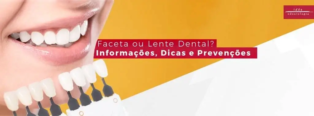 Faceta Dental ou Lente Dental? | Informações, Dicas e Prevenções