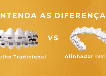 Aparelho Ortodontico Tradicional vs Alinhador Transparente Invisalign | Entenda as Diferenças